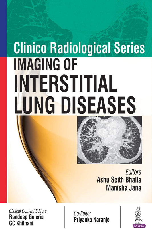 Clinico Radiological Series: Imaging of Interstitial Lung Diseases 1st Edition