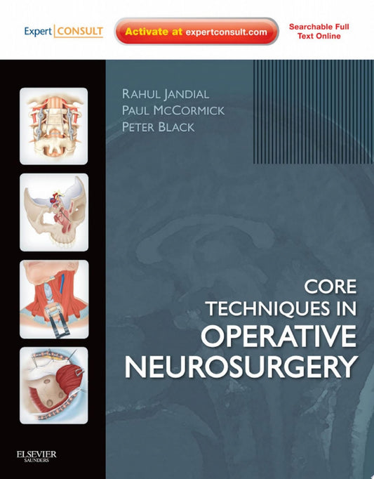 Core Techniques in Operative Neurosurgery: Expert Consult – Online and Print