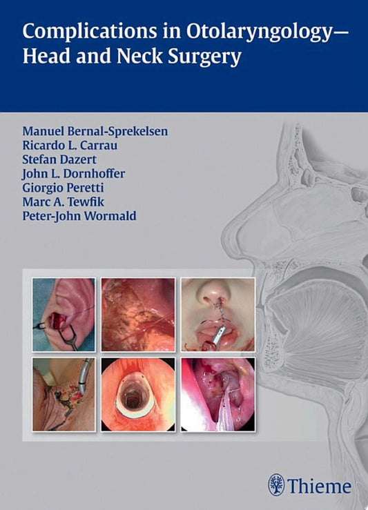 Complications in Otolaryngology-Head and Neck Surgery