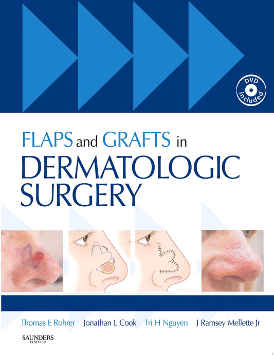 Flaps and Grafts in Dermatologic Surgery E-Book, 2nd Edition