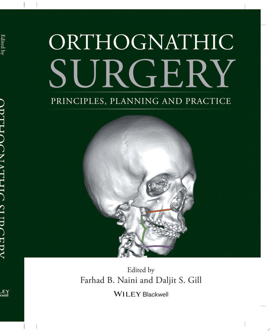 Orthognathic Surgery: Principles, Planning and Practice