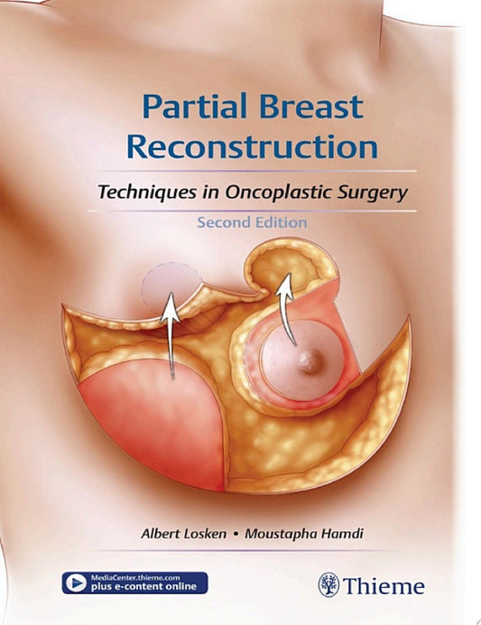 Partial Breast Reconstruction: Techniques in Oncoplastic Surgery, 2nd Edition (PDF + Videos)