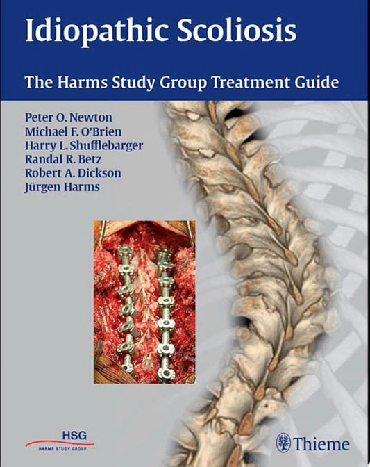 Idiopathic Scoliosis: The Harms Study Group Treatment Guide, 2nd edition