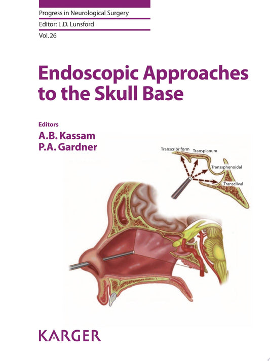 Endoscopic Approaches to the Skull Base