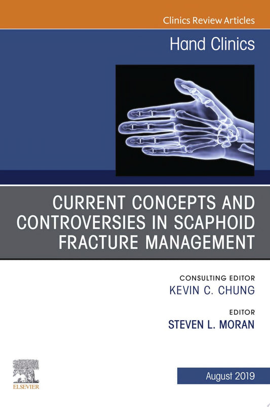 Current Concepts and Controversies in Scaphoid Fracture Management, An Issue of Hand Clinics