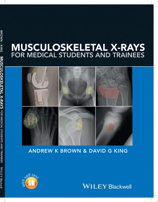 Musculoskeletal X-Rays for Medical Students and Trainees