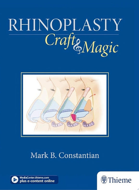 Rhinoplasty: Craft and Magic, 1ed