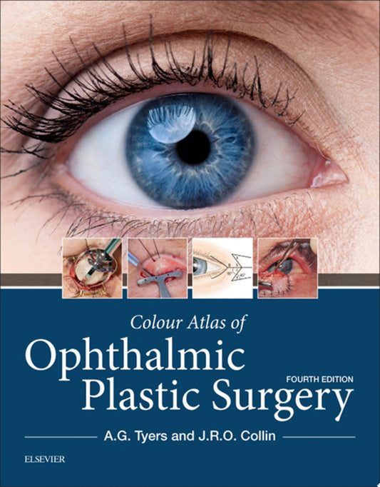 Colour Atlas of Ophthalmic Plastic Surgery, 4th Edition
