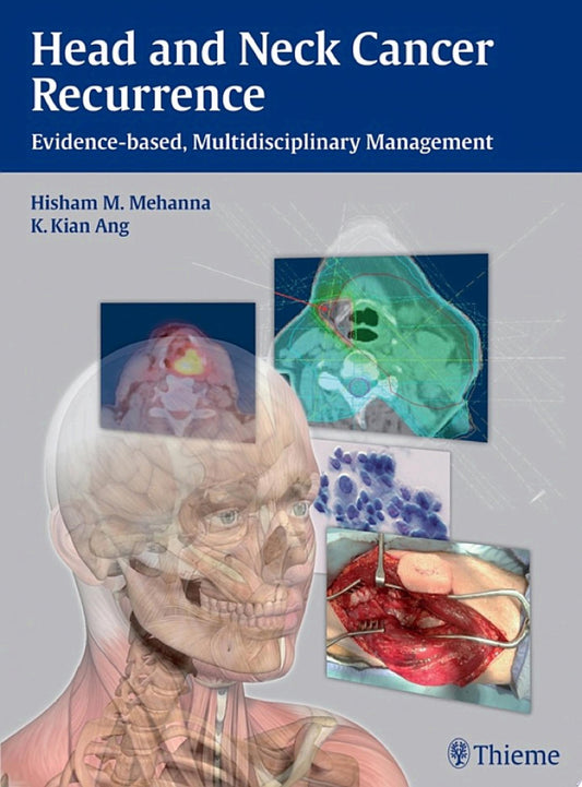 Head and Neck Cancer Recurrence: Evidence-Based, Multidisciplinary Management