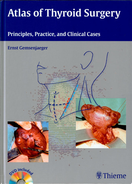 Atlas of Thyroid Surgery: Principles, Practice, and Clinical Cases