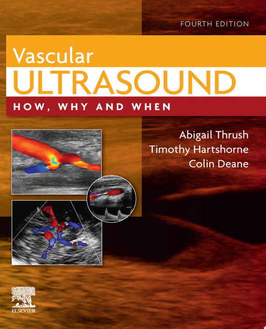 Vascular Ultrasound: How, Why and When, 4th Edition