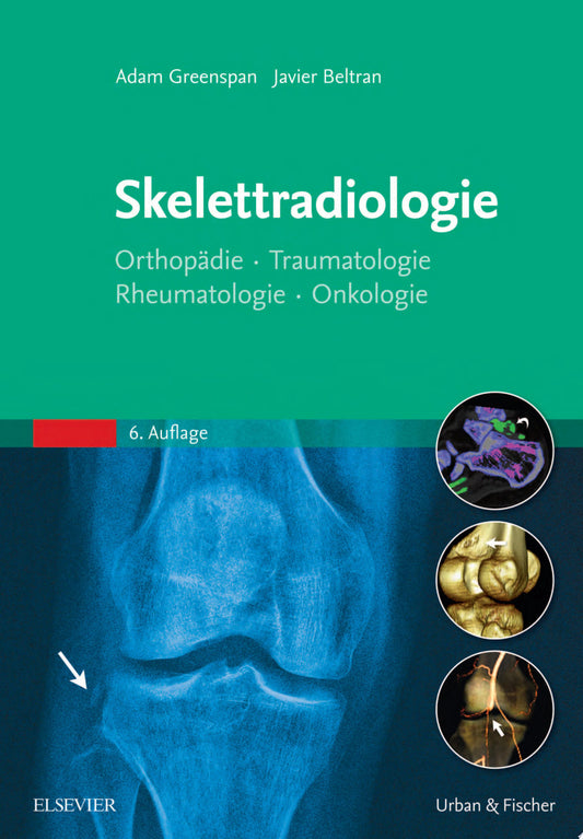 MRI of the Musculoskeletal System, 2nd Edition