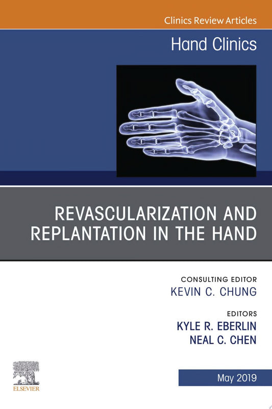 Revascularization and Replantation in the Hand, An Issue of Hand Clinics