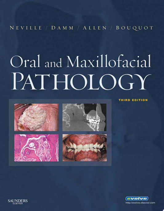 Oral and Maxillofacial Pathology, 3rd Edition