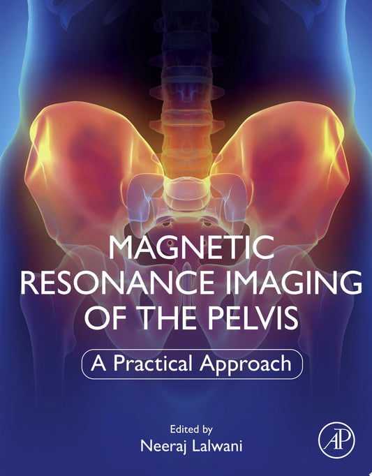 Magnetic Resonance Imaging of The Pelvis: A Practical Approach