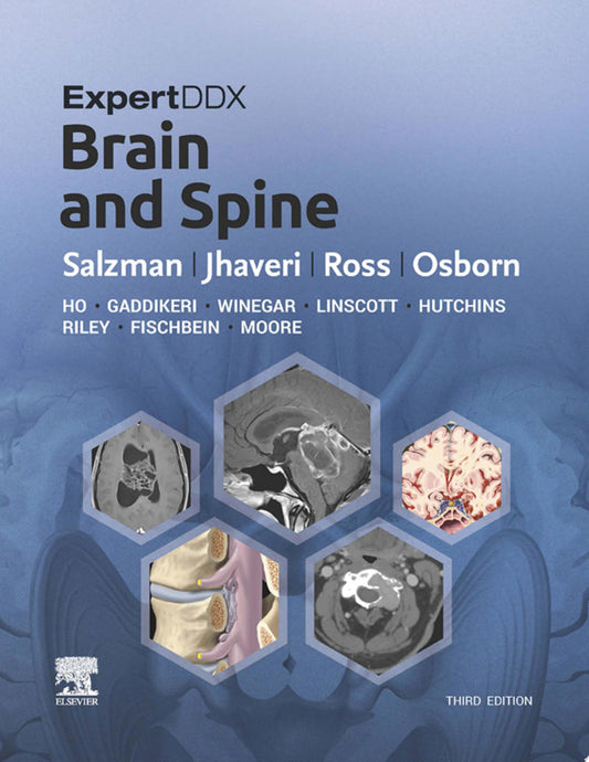 ExpertDDx: Brain and Spine, 3rd Edition