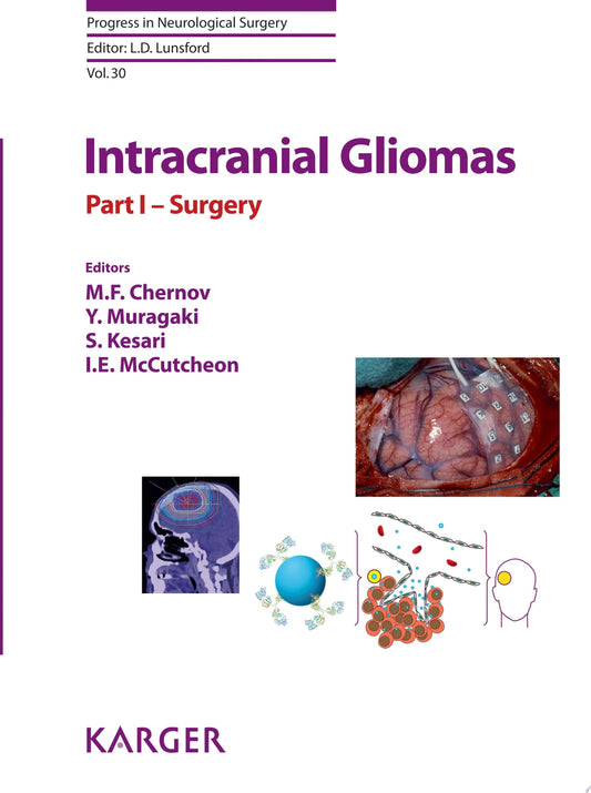 Intracranial Gliomas: Adjuvant Therapy