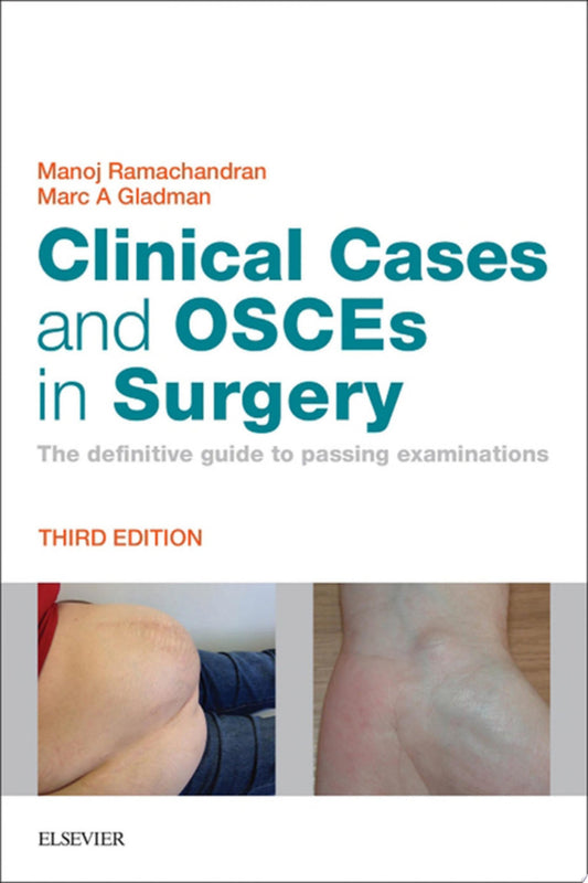 Clinical Cases and OSCEs in Surgery, 2e