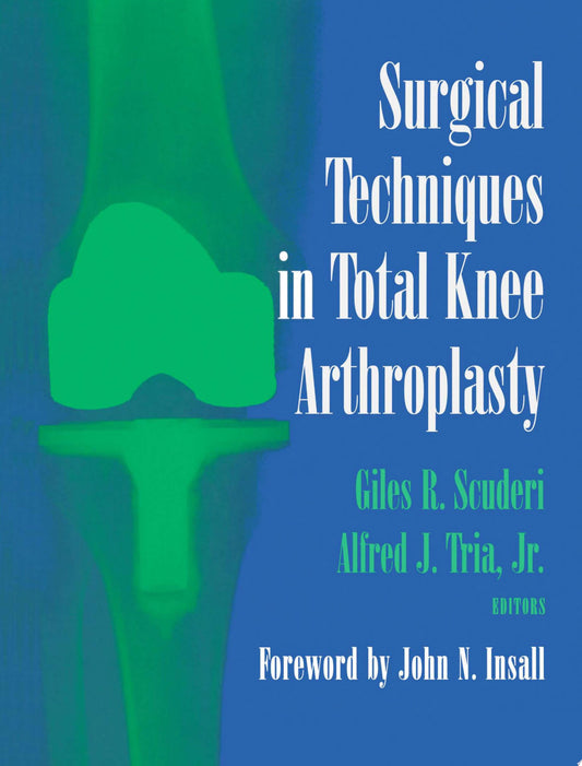 Total Knee Arthroplasty, 2nd Edition